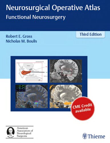 Neurosurgical operative atlas. Functional neurosurgery