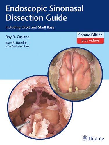 Endoscopic sinonasal dissection guide : including orbit and skull base