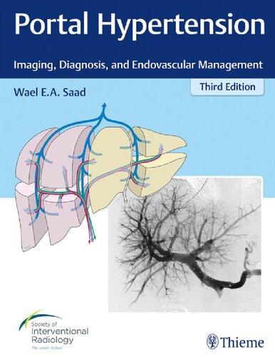 Portal hypertension imaging, diagnosis, and endovascular management