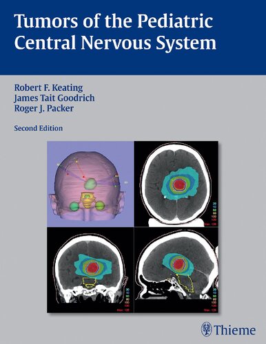 Tumors of the pediatric central nervous system