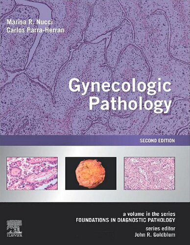 Gynecologic Pathology: A Volume in  Series