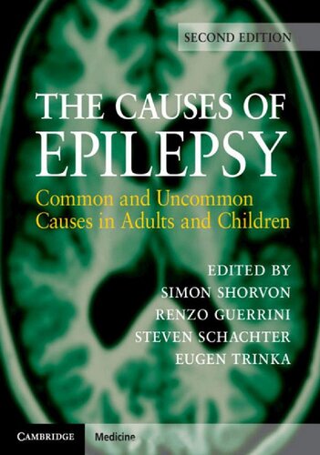 The Causes of Epilepsy: Common and Uncommon Causes in Adults and Children