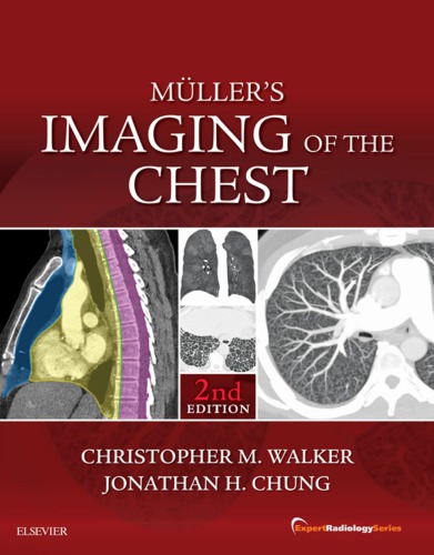 Muller’s Imaging of the Chest