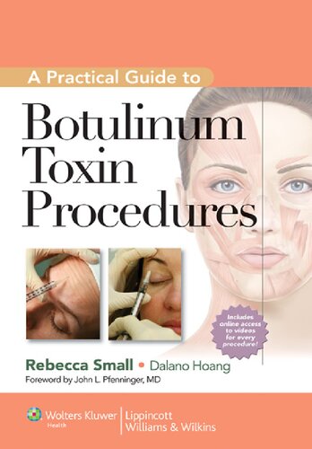 A practical guide to botulinum toxin injections