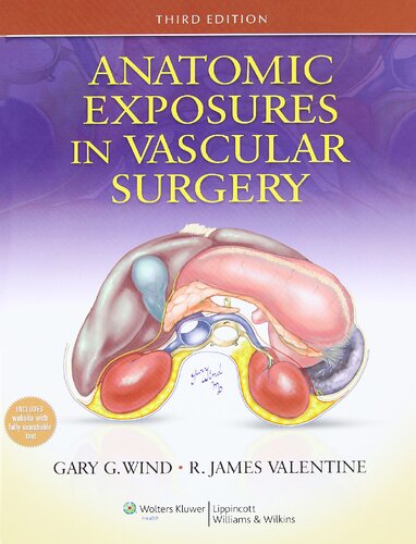 Anatomic exposures in vascular surgery