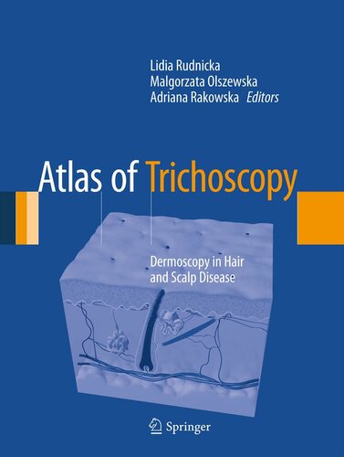 Atlas of Trichoscopy: Dermoscopy in Hair and Scalp Disease