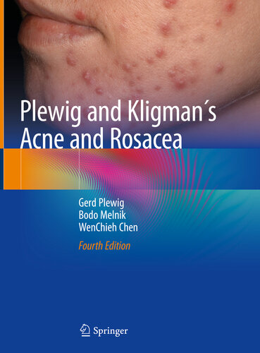 Plewig and Kligman’s Acne and Rosacea