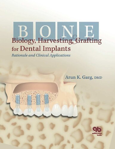 Bone Biology, Harvesting and Grafting for Dental Implants: Rationale and Clinical Applications