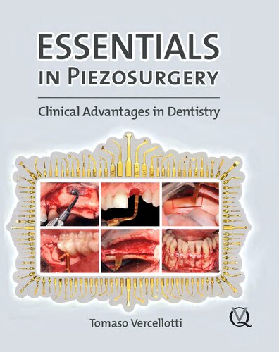 Essentials in Peiezosurgery: Clinical Advantages in Dentistry
