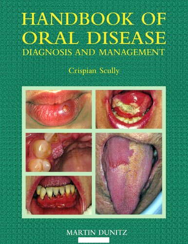 Handbook of Oral Disease: Diagnosis and Management