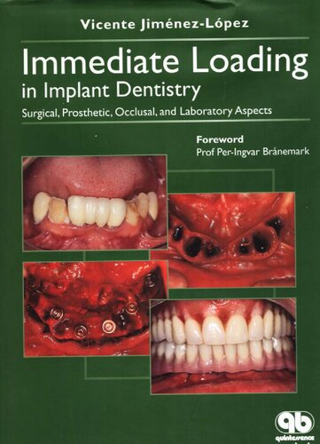Immediate Loading in Implant Dentistry: Surgical, Prosthetic, Occlusal, and Laboratory Aspects