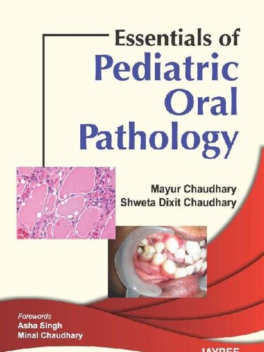 Essentials of Pediatric Oral Pathology