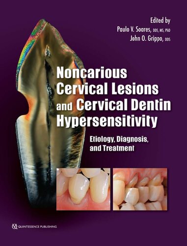 Noncarious Cervical Lesions and Cervical Dentin Hypersensitivity: Etiology, Diagnosis, and Treatment