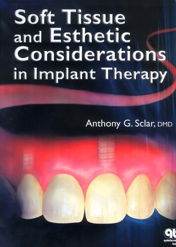 Soft Tissue and Esthetic Considerations in Implant Therapy