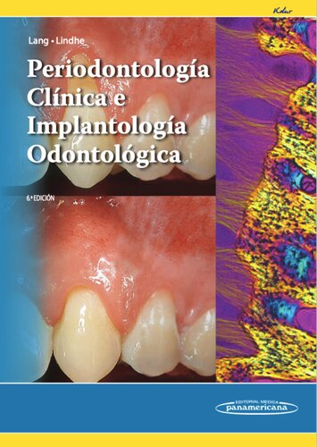 Periodontología Clínica e Implantología Odontológica TOMO 1 y 2 by KADUR