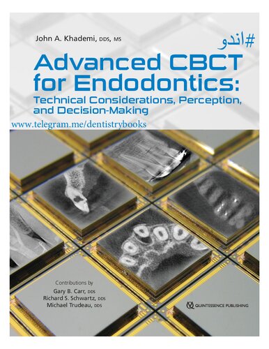 Advanced CBCT for Endodontics. Technical Considerations, Perception, and Decision-Making by KDUR