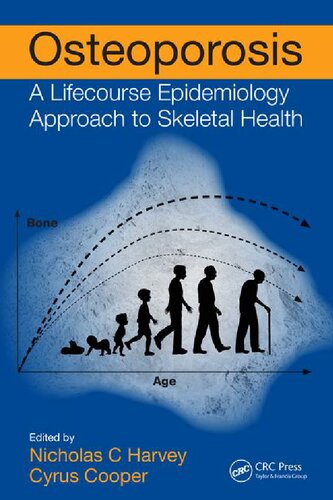 Osteoporosis : a lifecourse epidemiology approach to skeletal health
