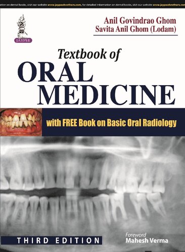 Textbook of oral medicine