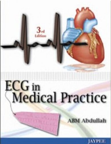 ECG in medical practice