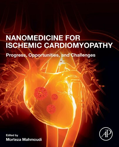 Nanomedicine for Ischemic Cardiomyopathy: Progress, Opportunities, and Challenges