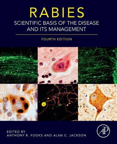Rabies: Scientific Basis of the Disease and Its Management