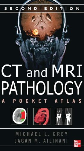 CT & MRI pathology : a pocket atlas
