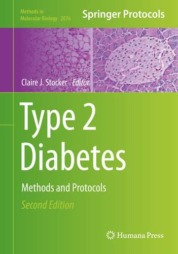 Type 2 Diabetes: Methods and Protocols