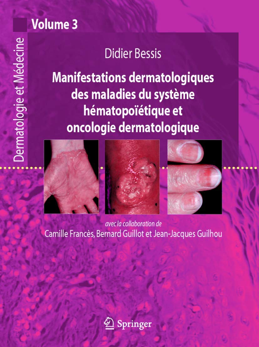 Manifestations dermatologiques des maladies du système hématopoiétique et oncologique dermatologique