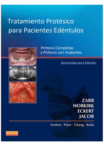 Tratamiento Protésico para Pacientes Edéntulos