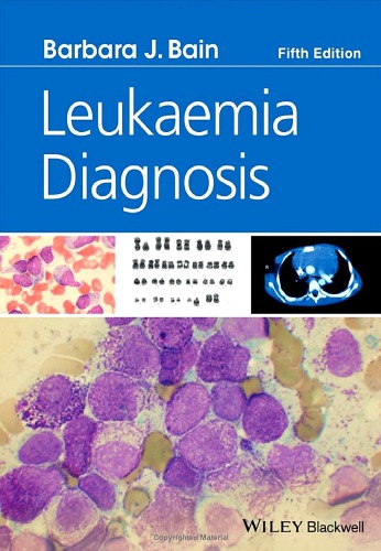 Leukaemia Diagnosis