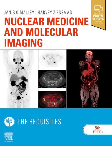 Nuclear Medicine and Molecular Imaging: The Requisites