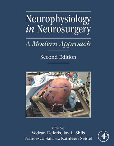 Neurophysiology in Neurosurgery: A Modern Approach