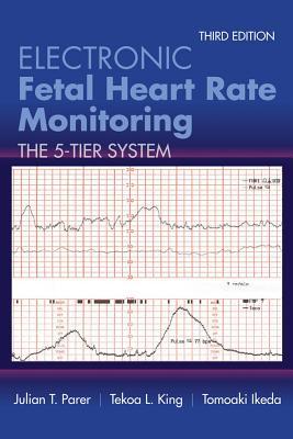 Electronic Fetal Heart Rate Monitoring: The 5-Tier System