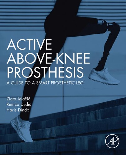 Active Above-Knee Prosthesis: A Guide to a Smart Prosthetic Leg