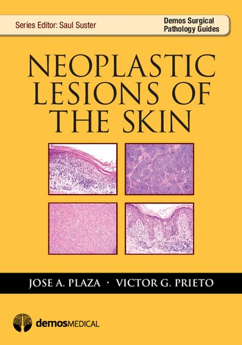 Neoplastic lesions of the skin