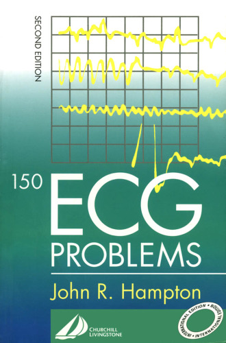 150 ECG Problems