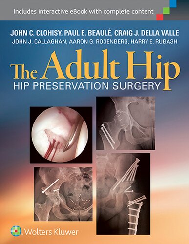The adult hip : hip preservation surgery
