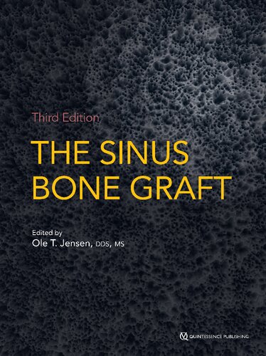 The sinus bone graft