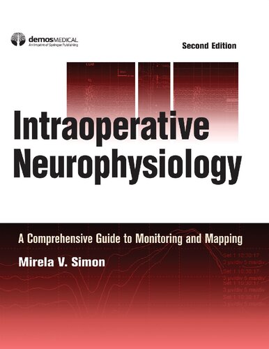 Intraoperative neurophysiology : a comprehensive guide to monitoring and mapping