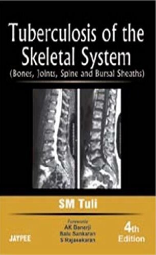 Tuberculosis of the Skeletal System : bones, joints, spine and bursal sheaths