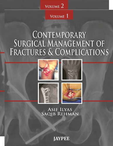 Contemporary surgical management of fractures &　complications