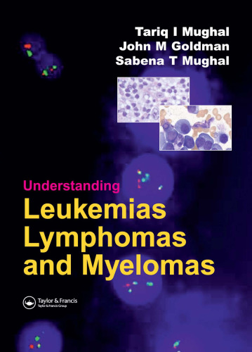 Understanding Leukemias, Lymphomas and Myelomas, Second Edition