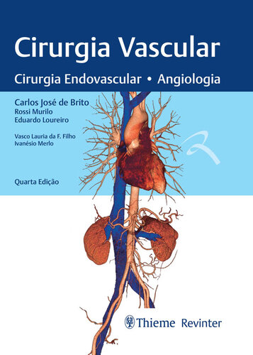 Cirurgia Vascular: Cirurgia Endovascular - Angiologia