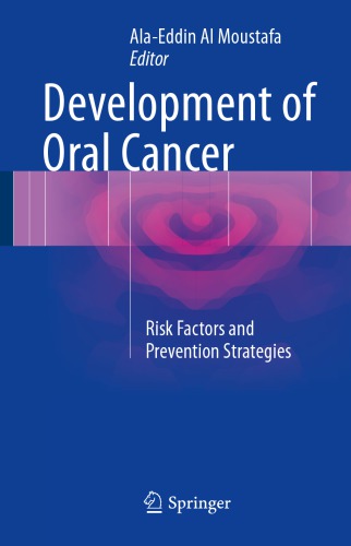 Development of oral cancer: risk factors and prevention strategies