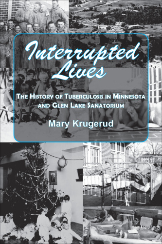 Interrupted lives: the history of tuberculosis in Minnesota and Glen Lake Sanatorium