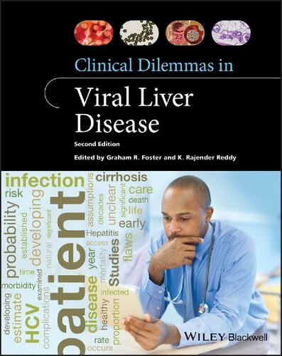 Clinical Dilemmas in Viral Liver Disease ()