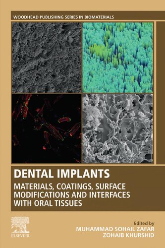 Dental Implants: Materials, Coatings, Surface Modifications and Interfaces with Oral Tissues (Woodhead Publishing Series in Biomaterials)