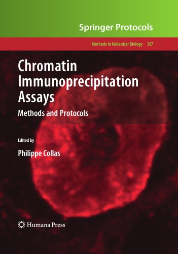 Chromatin immunoprecipitation assays: methods and protocols