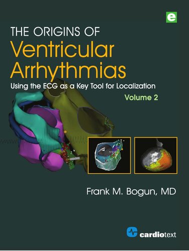 The Origins of Ventricular Arrhythmias: Using the ECG as a Key Tool for Localization, Volume 2