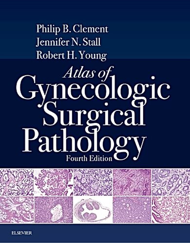 Atlas of Gynecologic Surgical Pathology